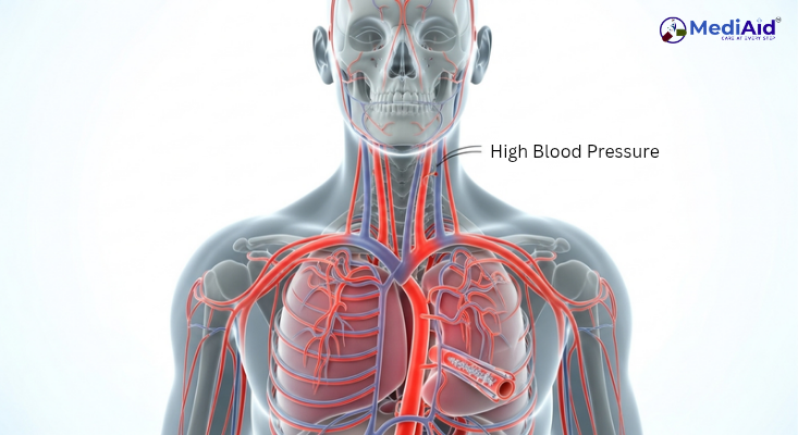 Hypertension Symptoms & Prevention | উচ্চ রক্তচাপ লক্ষণ ও প্রতিরোধ